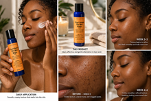 Load image into Gallery viewer, Skincare-I Can't Believe It’s Not Kojic