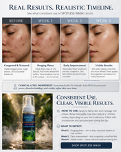 Load image into Gallery viewer, SPOTLESS Face Wash