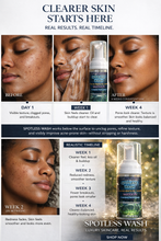 Load image into Gallery viewer, SPOTLESS Face Wash
